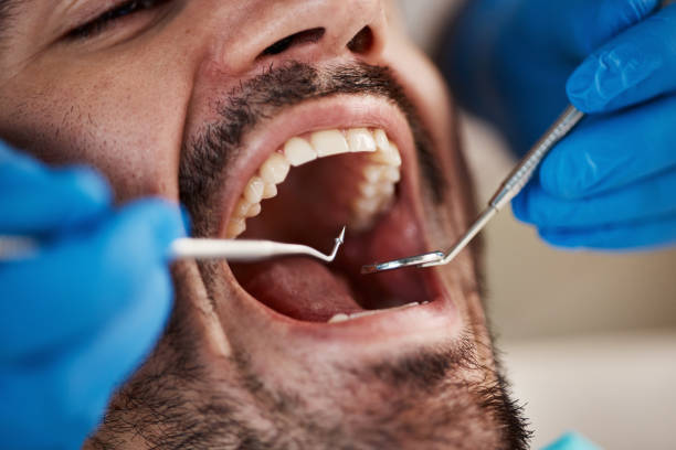 Professional Emergency Dentist in WY